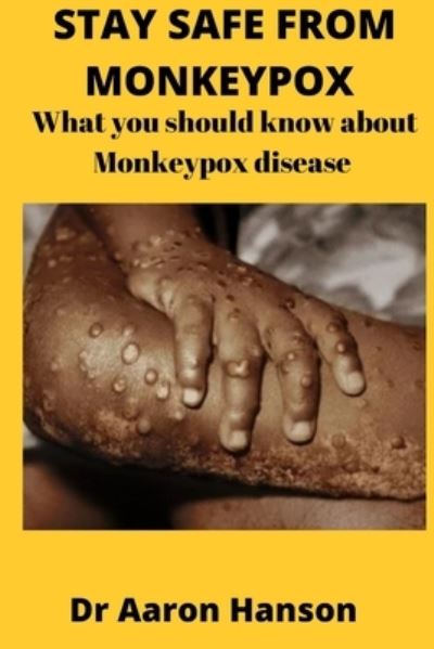 Stay Safe from Monkeypox: What You Should Know About Monkeypox Disease - Dr Aaron Hanson - Kirjat - Independently Published - 9798844026911 - torstai 4. elokuuta 2022