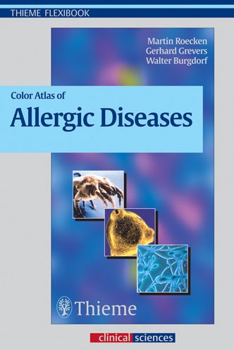 Cover for Martin Rocken · Color Atlas of Allergic Diseases (Paperback Book) (2003)