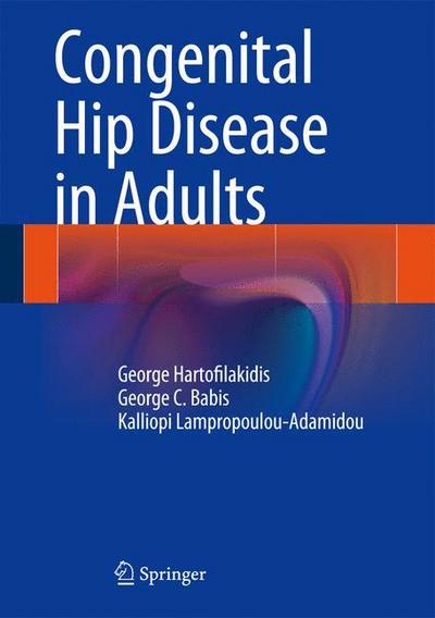 Cover for George Hartofilakidis · Congenital Hip Disease in Adults (Inbunden Bok) (2013)