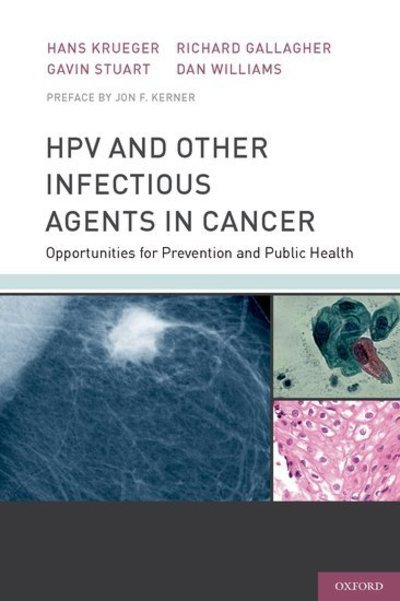HPV and Other Infectious Agents in Cancer: Opportunities for Prevention and Public Health - Krueger, Hans (, K. Krueger and Associates, Vancouver, BC, Canada) - Bøger - Oxford University Press Inc - 9780199732913 - 29. april 2010