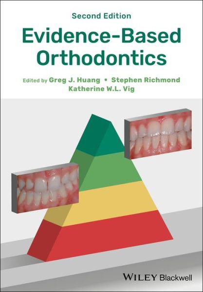 Evidence-Based Orthodontics - GJ Huang - Kirjat - John Wiley and Sons Ltd - 9781119289913 - perjantai 31. elokuuta 2018