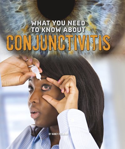 What You Need to Know about Conjunctivitis - Focus on Health - Nancy Dickmann - Boeken - Capstone Global Library Ltd - 9781474711913 - 11 augustus 2016