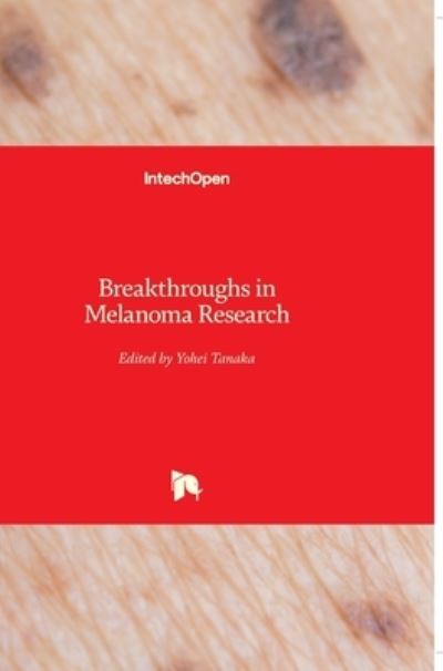 Cover for Yohei Tanaka · Breakthroughs in Melanoma Research (Hardcover Book) (2011)