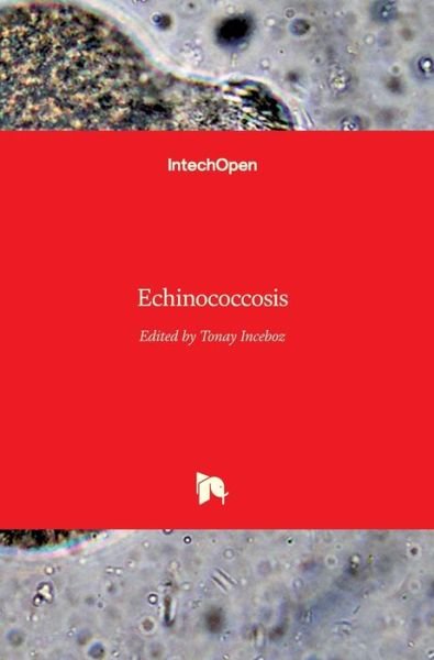 Cover for Tonay Inceboz · Echinococcosis (Hardcover bog) (2017)