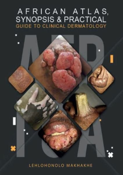 Cover for Lehlohonolo Makhakhe · African Atlas, Synopsis &amp; Practical Guide to Clinical Dermatology (Taschenbuch) (2020)