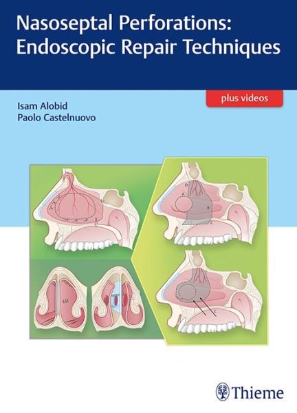Cover for Alobid Isam · Nasoseptal Perforations: Endoscopic Repair Techniques (Gebundenes Buch) [1. Ausgabe] (2017)