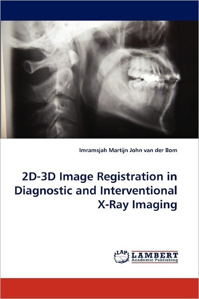Cover for Imramsjah Martijn John Van Der Bom · 2d-3d Image Registration in Diagnostic and Interventional X-ray Imaging (Paperback Book) (2011)