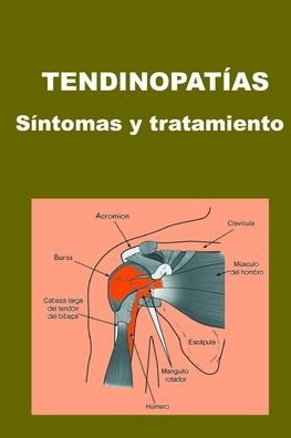 Cover for Adolfo Perez Agusti · Tendinopatias (Pocketbok) (2020)