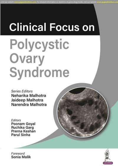 Cover for Neharika Malhotra · Clinical Focus on Polycystic Ovary Syndrome (Paperback Book) (2022)