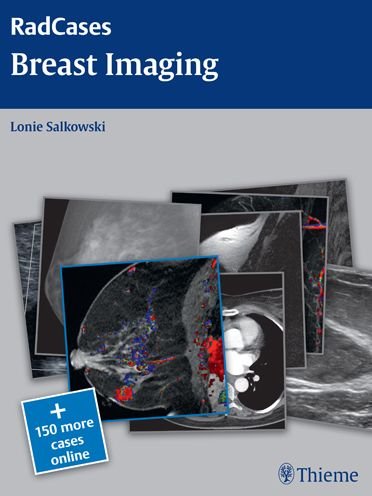 Radcases Breast Imaging - Radcases Plus Q&A - Lonie L. Salkowski - Bøger - Thieme Medical Publishers Inc - 9781604061918 - 26. november 2013