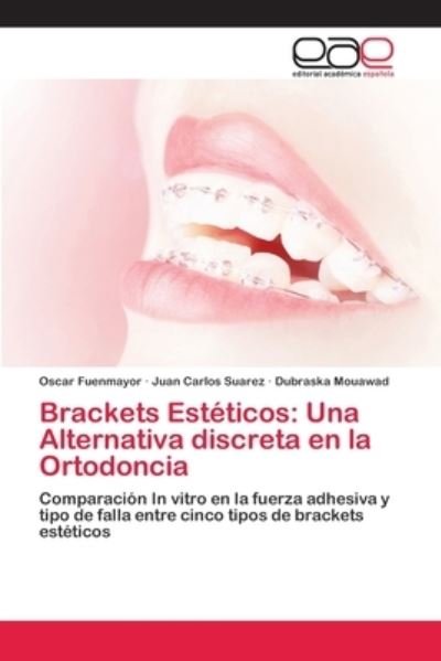 Cover for Fuenmayor · Brackets Estéticos: Una Alter (Bog) (2018)
