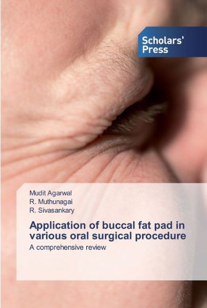Cover for Agarwal · Application of buccal fat pad i (Bog) (2019)