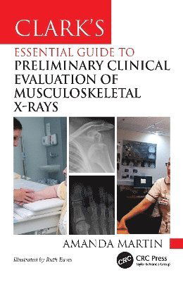 Cover for Amanda Martin · Clark’s Essential Guide to Preliminary Clinical Evaluation of Musculoskeletal X-rays - Clark's Companion Essential Guides (Paperback Book) (2025)