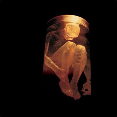 Cover for Alice in Chains · Noting Safe (CD) (1999)