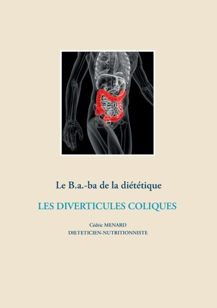 Cover for Cedric Menard · Le B.a.-ba de la dietetique des diverticules coliques (Taschenbuch) (2020)