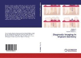 Cover for S. · Diagnostic Imaging In Implant Dentis (Book)