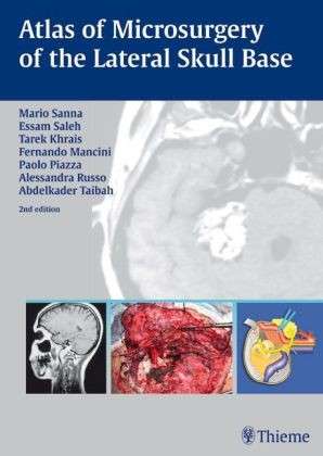 Cover for Mario Sanna · Atlas of Microsurgery of the Lateral Skull Base (Hardcover Book) (2007)