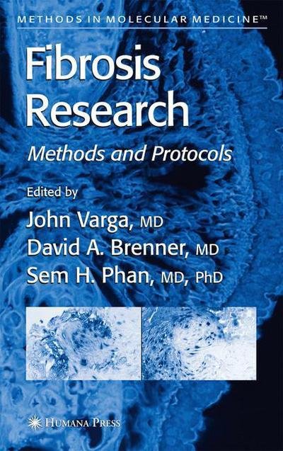 Cover for John Varga · Fibrosis Research: Methods and Protocols - Methods in Molecular Medicine (Paperback Book) [Softcover reprint of hardcover 1st ed. 2005 edition] (2010)