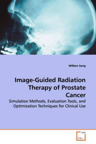 Cover for William Song · Image-guided Radiation Therapy of Prostate Cancer: Simulation Methods, Evaluation Tools, and Optimization Techniques for Clinical Use (Paperback Book) (2009)
