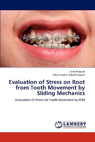 Cover for Nillachandra Kshetrimayum · Evaluation of Stress on Root from Tooth Movement by Sliding Mechanics: Evaluation of Stress on Tooth Movement by Fem (Paperback Book) (2012)