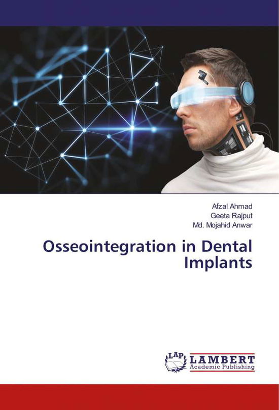 Cover for Ahmad · Osseointegration in Dental Implan (Book)