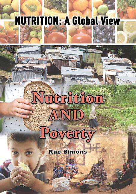 Cover for Rae Simons · Nutrition and Poverty (Paperback Book) (2016)