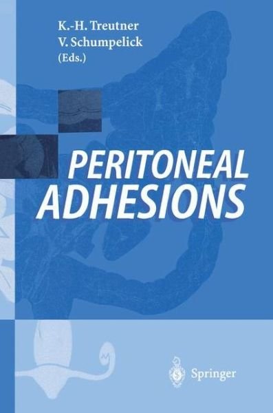 Cover for K H Treutner · Peritoneal Adhesions (Paperback Book) (1996)