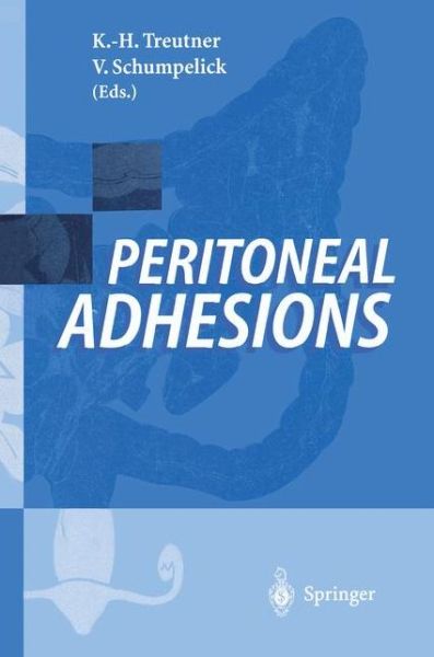 Peritoneal Adhesions - K H Treutner - Bøger - Springer-Verlag Berlin and Heidelberg Gm - 9783540611929 - 2. oktober 1996