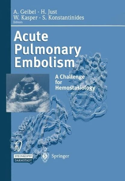Acute Pulmonary Embolism: A Challenge for Hemostasiology - A Geibel - Livres - Steinkopff Darmstadt - 9783642511929 - 19 mai 2012