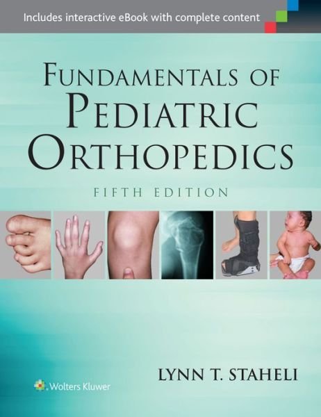 Cover for Lynn T. Staheli · Fundamentals of Pediatric Orthopedics (Hardcover Book) (2015)