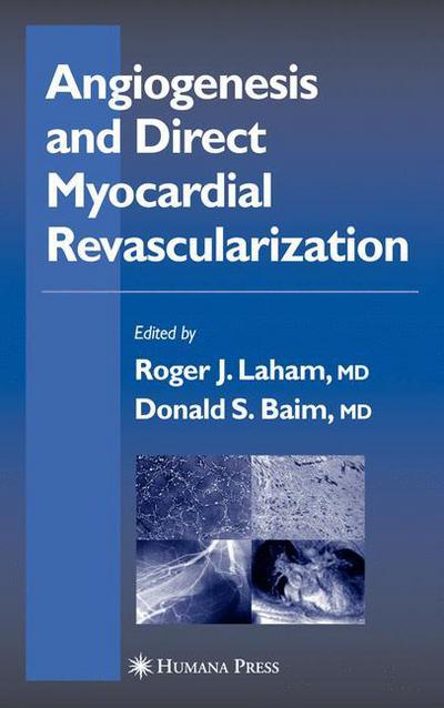 Cover for Roger J Laham · Angiogenesis and Direct Myocardial Revascularization - Contemporary Cardiology (Paperback Book) [Softcover reprint of hardcover 1st ed. 2005 edition] (2010)