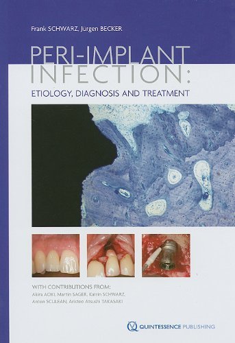 Cover for Jürgen Becker · Peri-implant Infection: Etiology, Diagnosis and Treatment (Gebundenes Buch) (2009)