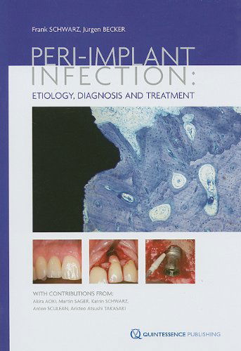 Cover for Jürgen Becker · Peri-implant Infection: Etiology, Diagnosis and Treatment (Hardcover Book) (2009)