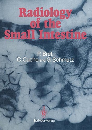 Cover for Pierre Bret · Radiology of the small intestine (Pocketbok) [Softcover reprint of the original 1st ed. 1989 edition] (2014)