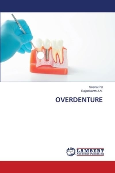 Cover for Pal · Overdenture (Bog) (2020)