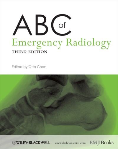 Cover for O Chan · ABC of Emergency Radiology - ABC Series (Pocketbok) (2013)