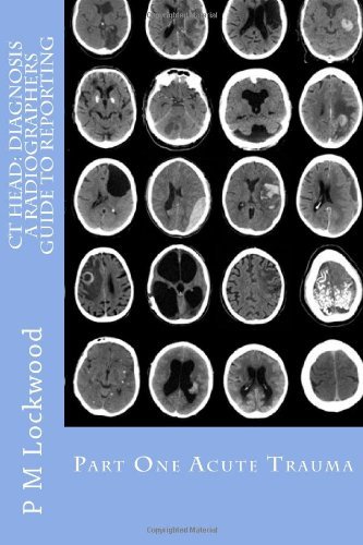 Cover for P M Lockwood · Ct Head: Diagnosis  a Radiographers Guide to Reporting Part 1 Acute Trauma: Part One Acute Trauma (Paperback Book) (2011)