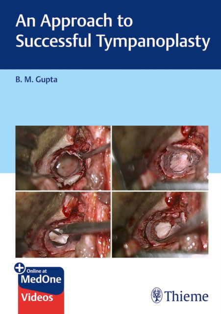 B Gupta · An Approach to Successful Tympanoplasty (N/A) (2024)