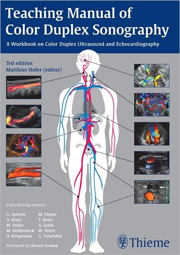 Cover for Matthias Hofer · Teaching Manual of Color Duplex Sonography (Pocketbok) (2010)