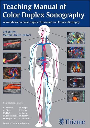 Teaching Manual of Color Duplex Sonography - Matthias Hofer - Livros - Thieme Publishing Group - 9783131275936 - 11 de agosto de 2010