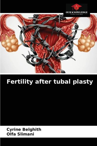 Cover for Cyrine Belghith · Fertility after tubal plasty (Taschenbuch) (2021)