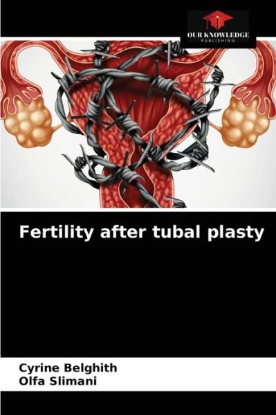 Cover for Cyrine Belghith · Fertility after tubal plasty (Paperback Book) (2021)