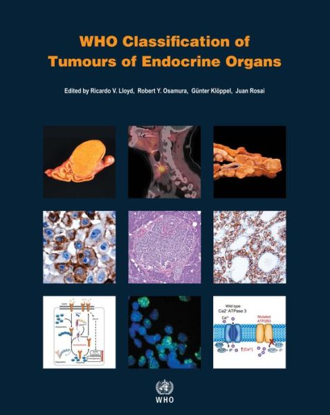 Cover for International Agency for Research on Cancer · WHO Classification of Tumours of Endocrine Organs (Book) (2017)