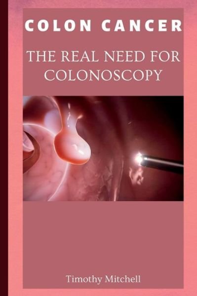 Cover for Timothy Mitchell · Colon Cancer: The Real Need for Colonoscopy (Paperback Book) (2022)
