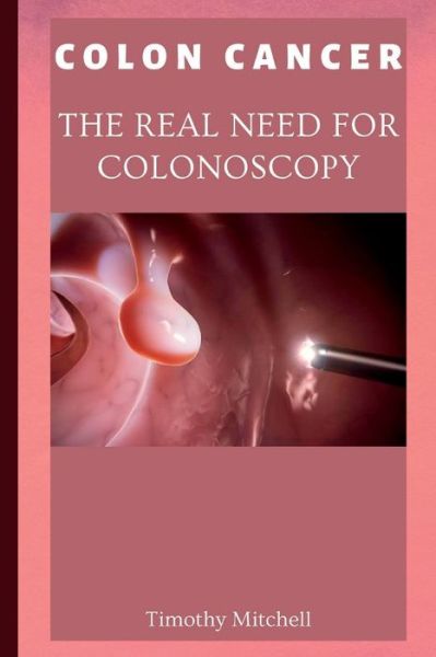 Colon Cancer: The Real Need for Colonoscopy - Timothy Mitchell - Books - Independently Published - 9798844470936 - August 7, 2022