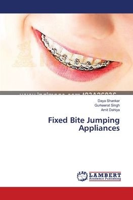 Cover for Shankar · Fixed Bite Jumping Appliances (Book) (2013)