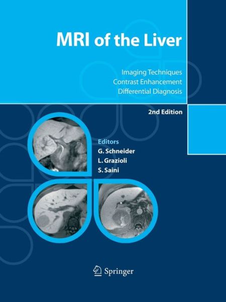 Cover for MRI of the Liver: Imaging Techniques, Contrast Enhancement, Differential Diagnosis (Paperback Book) [Softcover reprint of the original 2nd ed. 2006 edition] (2016)