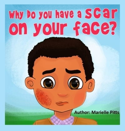 Marielle Pitts · Why do you have a scar on your face? (Hardcover Book) (2019)