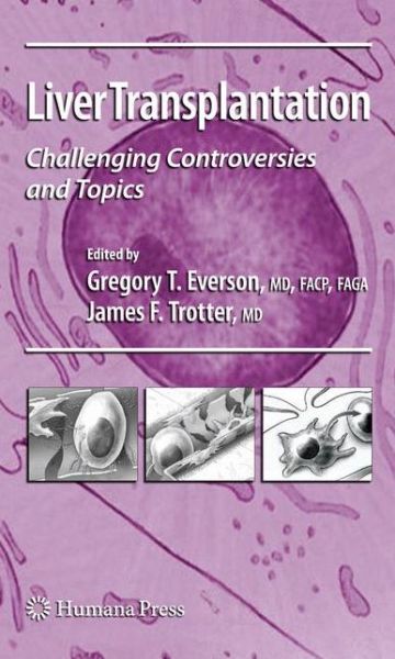 Cover for Gregory T Everson · Liver Transplantation: Challenging Controversies and Topics - Clinical Gastroenterology (Hardcover Book) [2009 edition] (2008)