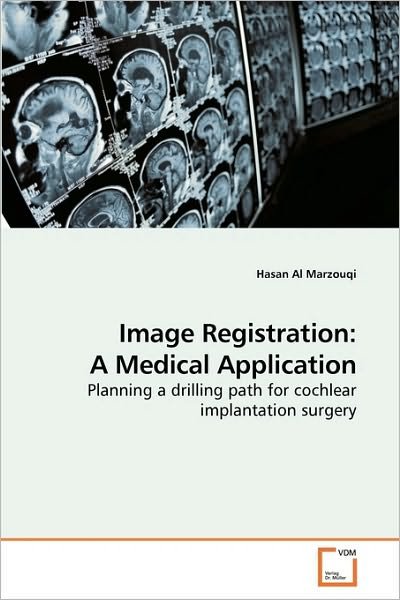 Cover for Hasan Al Marzouqi · Image Registration: a Medical Application: Planning a Drilling Path for Cochlear Implantation Surgery (Pocketbok) (2010)